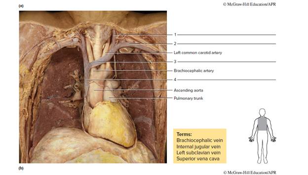 Chapter 64, Problem F64.8A, FIGURE 64.8 Identify the veins on the ventral (anterior) views of the thorax of the (a) fetal pig , example  2